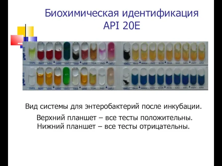 Биохимическая идентификация API 20E Вид системы для энтеробактерий после инкубации.