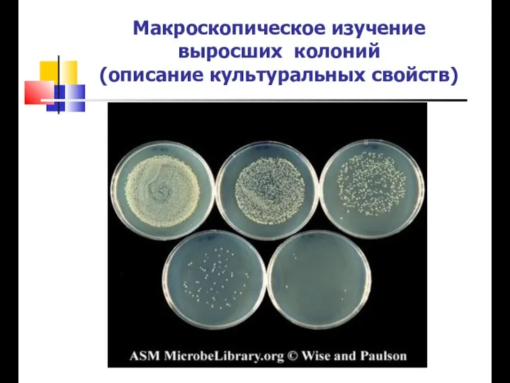 Макроскопическое изучение выросших колоний (описание культуральных свойств)