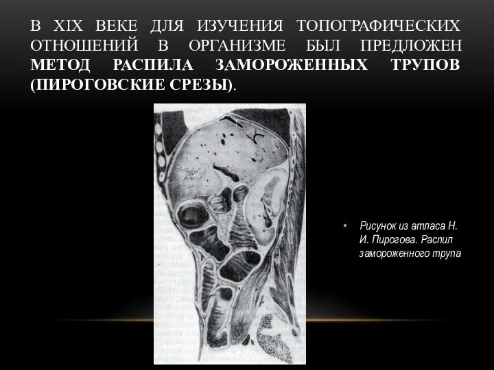 В XIX ВЕКЕ ДЛЯ ИЗУЧЕНИЯ ТОПОГРАФИЧЕСКИХ ОТНОШЕНИЙ В ОРГАНИЗМЕ БЫЛ