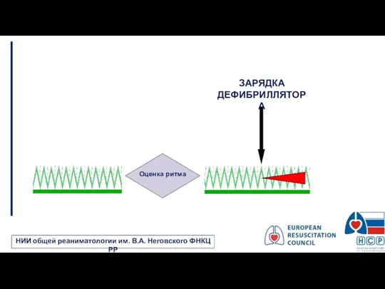 ЗАРЯДКА ДЕФИБРИЛЛЯТОРА НИИ общей реаниматологии им. В.А. Неговского ФНКЦ РР