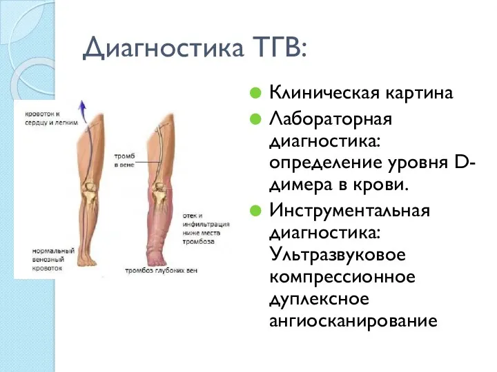 Диагностика ТГВ: Клиническая картина Лабораторная диагностика: определение уровня D-димера в