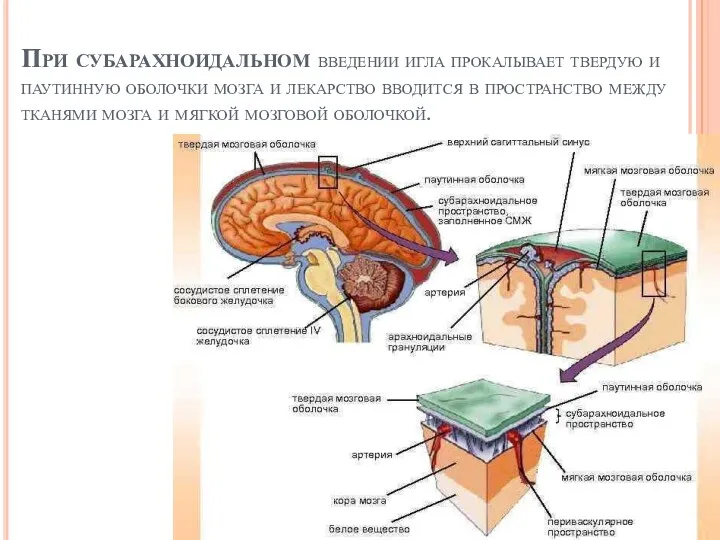 При субарахноидальном введении игла прокалывает твердую и паутинную оболочки мозга