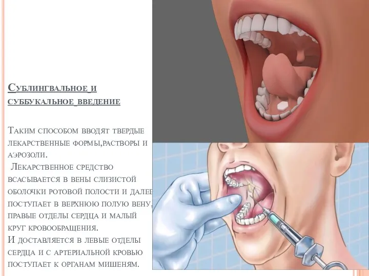 Сублингвальное и суббукальное введение Таким способом вводят твердые лекарственные формы,растворы