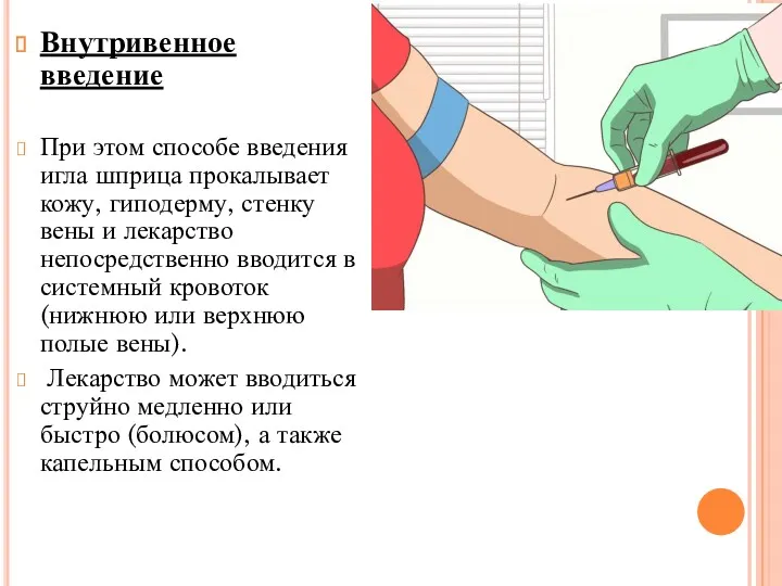 Внутривенное введение При этом способе введения игла шприца прокалывает кожу,