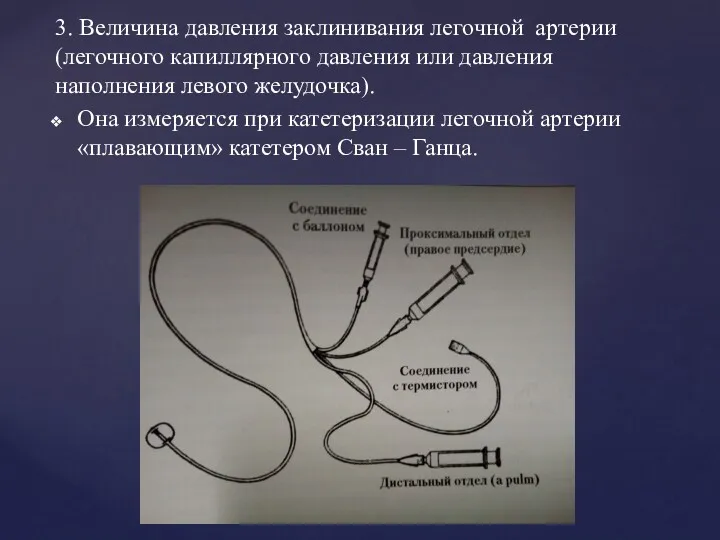 3. Величина давления заклинивания легочной артерии (легочного капиллярного давления или