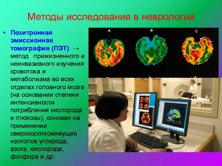 Методы исследования в неврологии Позитронная эмиссионная томография (ПЭТ) → метод