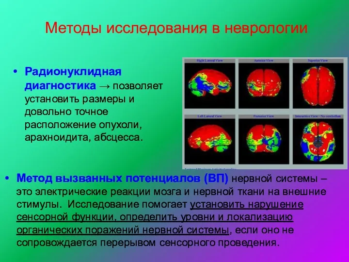 Методы исследования в неврологии Радионуклидная диагностика → позволяет установить размеры