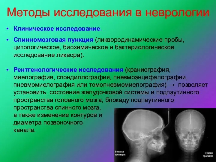 Методы исследования в неврологии Клиническое исследование. Спинномозговая пункция (ликвородинамические пробы,