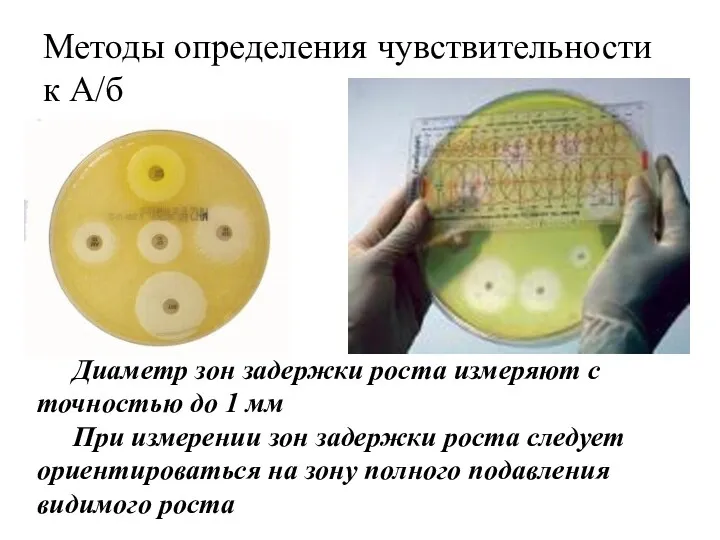 Методы определения чувствительности к А/б Диаметр зон задержки роста измеряют с точностью до