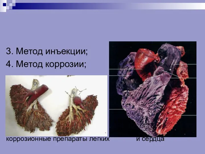 3. Метод инъекции; 4. Метод коррозии; коррозионные препараты легких и сердца