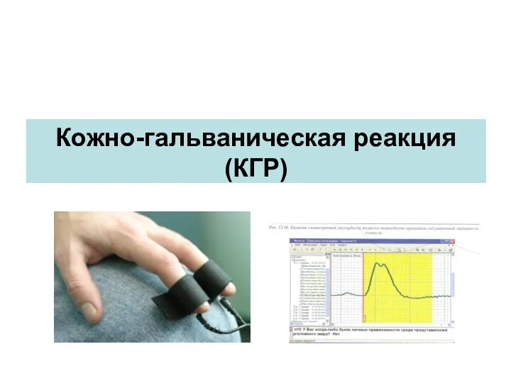 Кожно-гальваническая реакция (КГР)