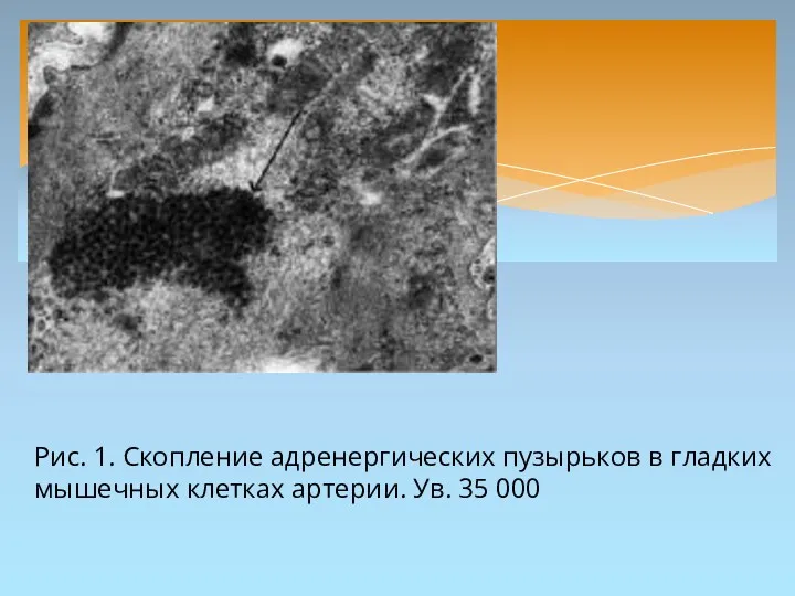 Рис. 1. Скопление адренергических пузырьков в гладких мышечных клетках артерии. Ув. 35 000