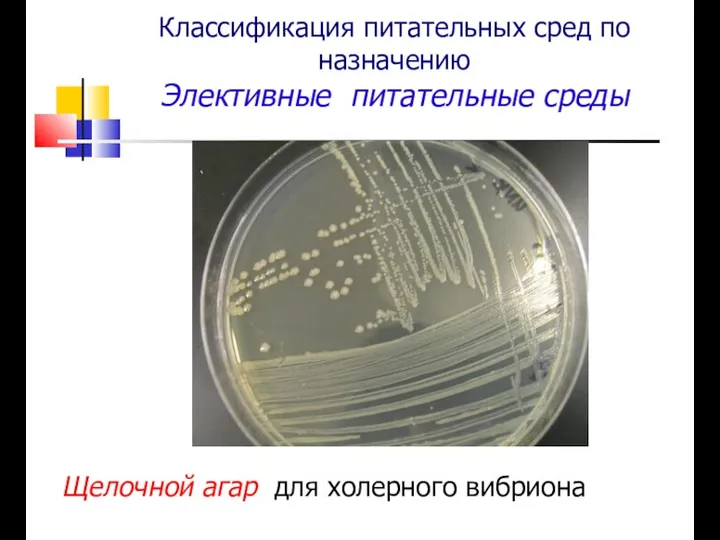 Классификация питательных сред по назначению Элективные питательные среды Щелочной агар для холерного вибриона