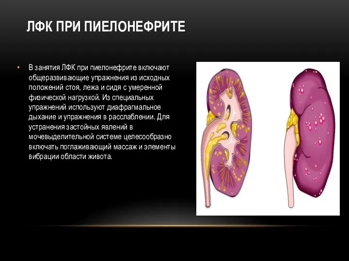 ЛФК ПРИ ПИЕЛОНЕФРИТЕ В занятия ЛФК при пиелонефрите включают общеразвивающие