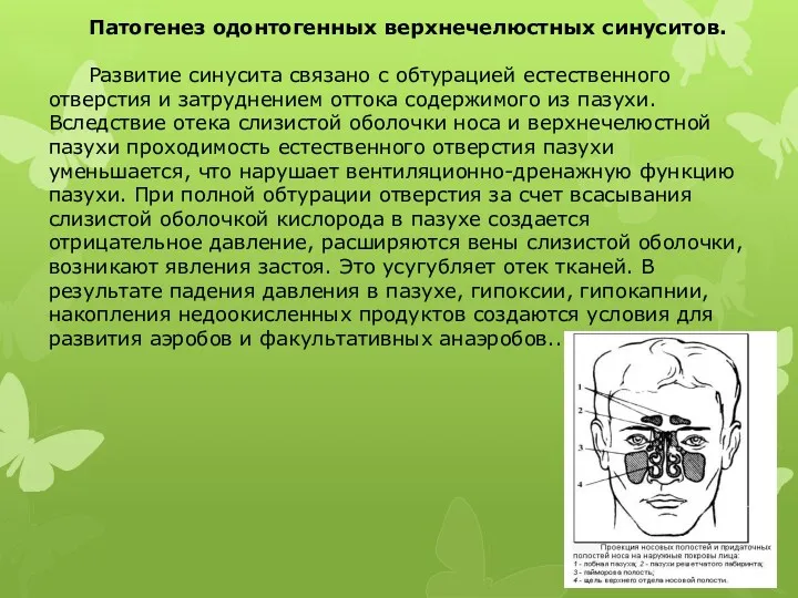 Патогенез одонтогенных верхнечелюстных синуситов. Развитие синусита связано с обтурацией естественного