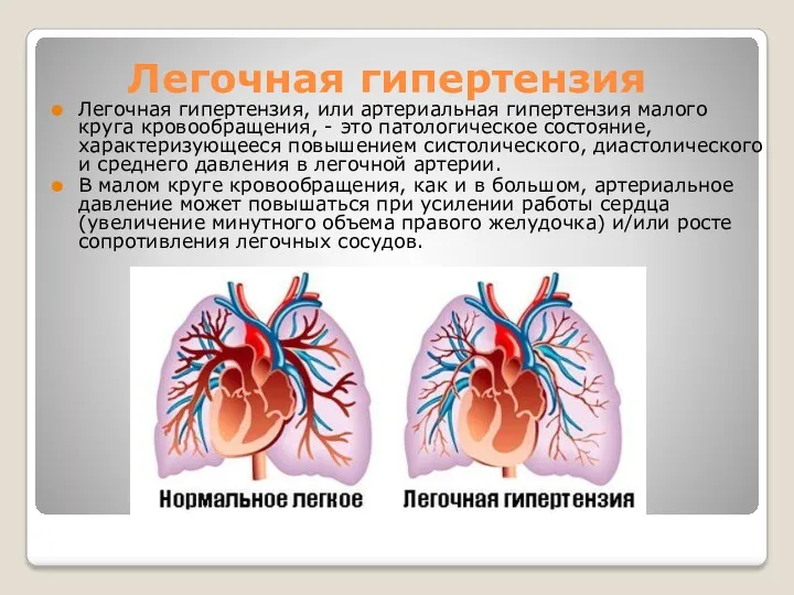 Легочная гипертензия Легочная гипертензия, или артериальная гипертензия малого круга кровообращения,