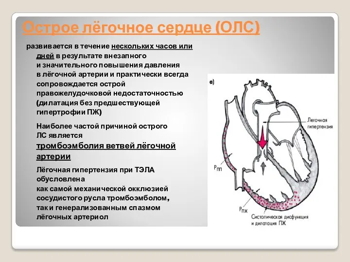 Острое лёгочное сердце (ОЛС) развивается в течение нескольких часов или