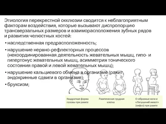 Этиология перекрестной окклюзии сводится к неблагоприятным факторам воздействия, которые вызывают