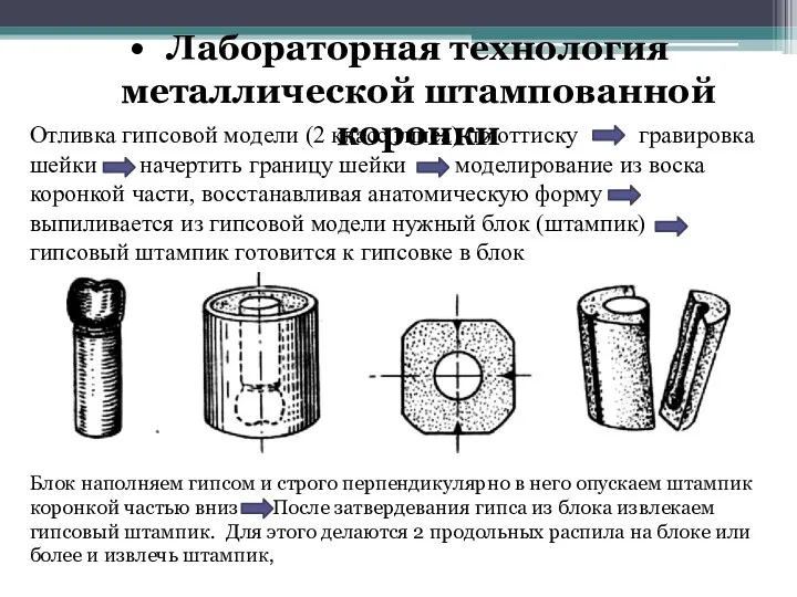 Лабораторная технология металлической штампованной коронки Отливка гипсовой модели (2 класс