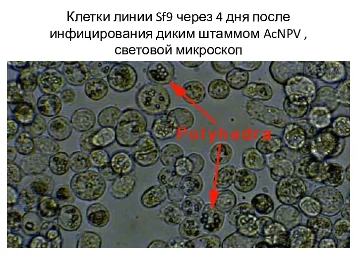 Клетки линии Sf9 через 4 дня после инфицирования диким штаммом AcNPV , световой микроскоп