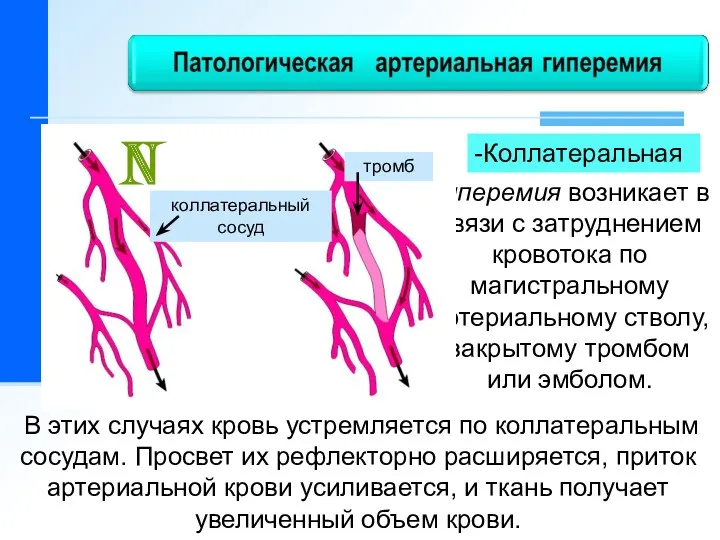 гиперемия возникает в связи с затруднением кровотока по магистральному артериальному