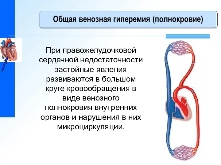 При правожелудочковой сердечной недостаточности застойные явления развиваются в большом круге