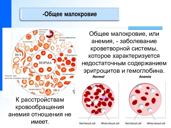 Общее малокровие, или анемия, - заболевание кроветворной системы, которое характеризуется