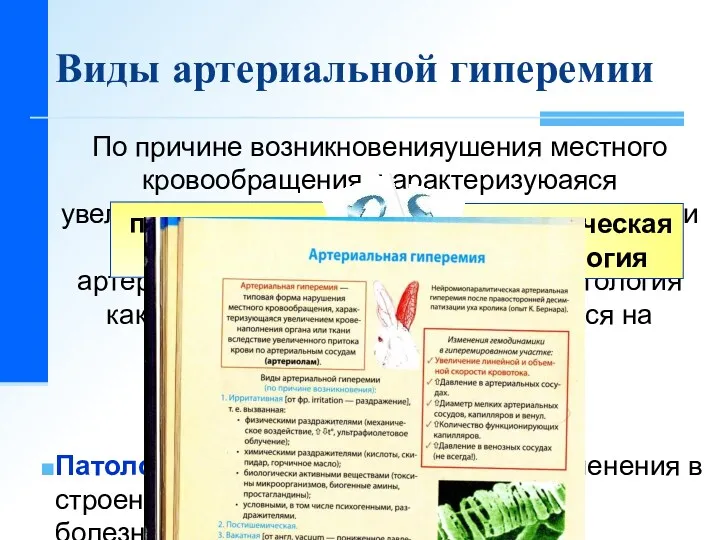 Виды артериальной гиперемии По причине возникновенияушения местного кровообращения, характеризуюаяся увеличением