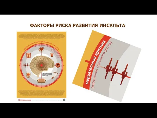 ФАКТОРЫ РИСКА РАЗВИТИЯ ИНСУЛЬТА