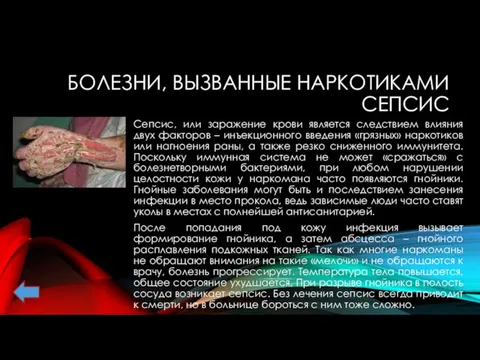 БОЛЕЗНИ, ВЫЗВАННЫЕ НАРКОТИКАМИ СЕПСИС Сепсис, или заражение крови является следствием