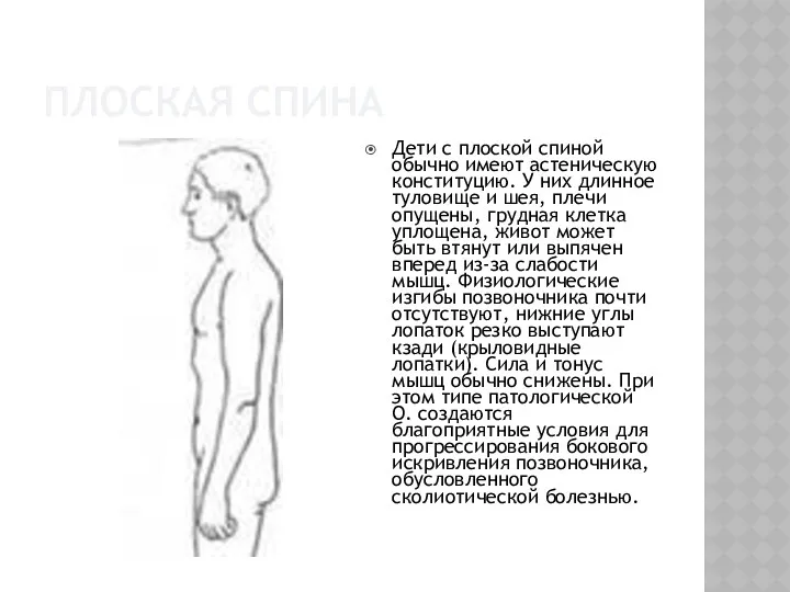 ПЛОСКАЯ СПИНА Дети с плоской спиной обычно имеют астеническую конституцию. У них длинное