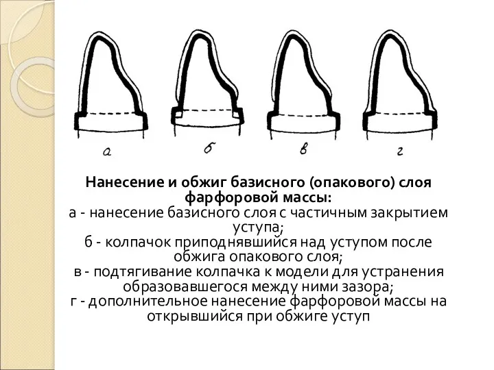 Нанесение и обжиг базисного (опакового) слоя фарфоровой массы: а -