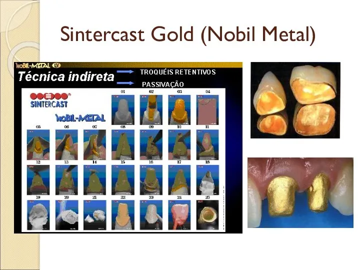 Sintercast Gold (Nobil Metal)
