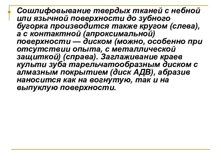 Сошлифовывание твердых тканей с небной или язычной поверхности до зубного