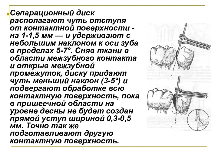 Сепарационный диск располагают чуть отступя от контактной поверхности - на