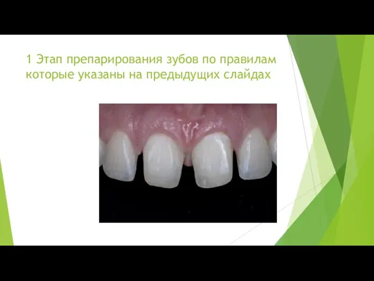 1 Этап препарирования зубов по правилам которые указаны на предыдущих слайдах