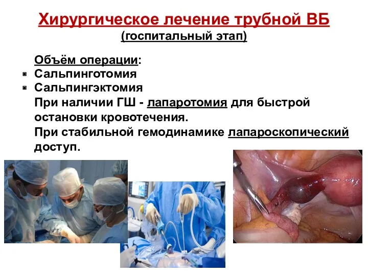 Хирургическое лечение трубной ВБ (госпитальный этап) Объём операции: Сальпинготомия Сальпингэктомия При наличии ГШ