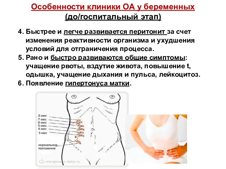 Особенности клиники ОА у беременных (до/госпитальный этап) 4. Быстрее и легче развивается перитонит