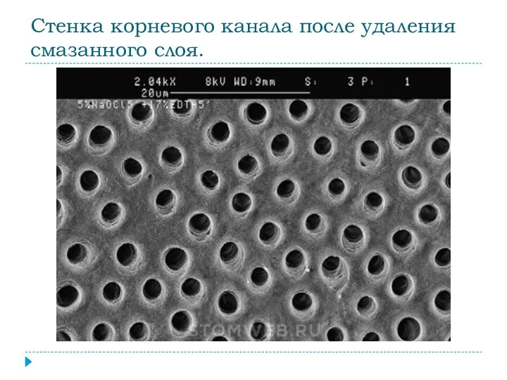 Стенка корневого канала после удаления смазанного слоя.