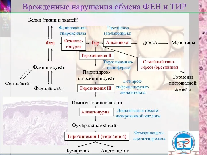 Белки (пищи и тканей) Фен Врожденные нарушения обмена ФЕН и