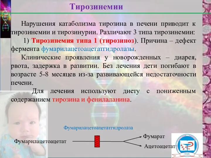 Нарушения катаболизма тирозина в печени приводит к тирозинемии и тирозинурии.