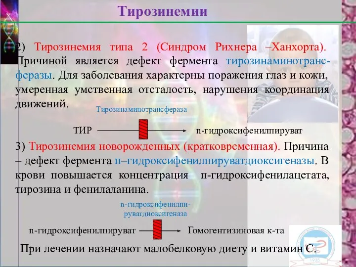 2) Тирозинемия типа 2 (Синдром Рихнера –Ханхорта). Причиной является дефект