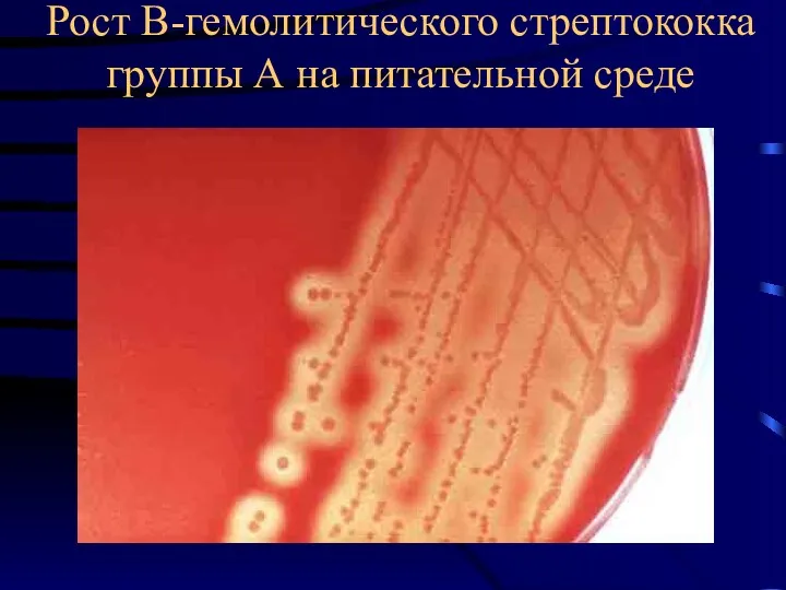 Рост В-гемолитического стрептококка группы А на питательной среде