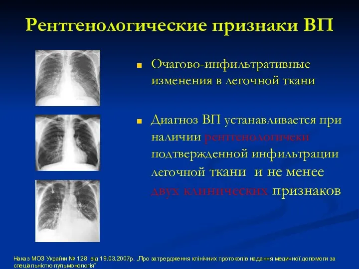 Рентгенологические признаки ВП Очагово-инфильтративные изменения в легочной ткани Диагноз ВП