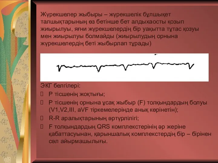 Жүрекшелер жыбыры – жүрекшелік бұлшықет талшықтарының өз бетінше бет алдыхаосты