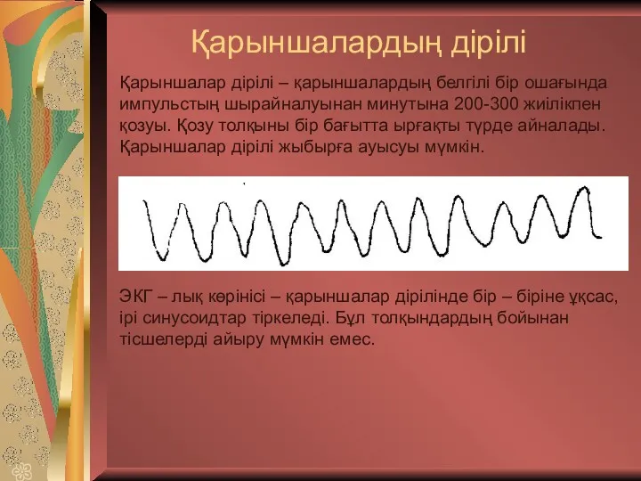 Қарыншалардың дірілі Қарыншалар дірілі – қарыншалардың белгілі бір ошағында импульстың