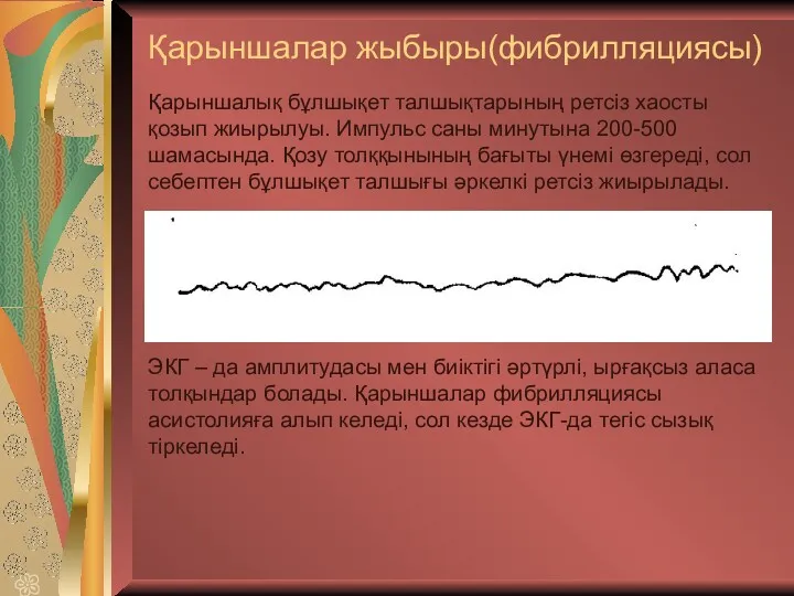 Қарыншалар жыбыры(фибрилляциясы) Қарыншалық бұлшықет талшықтарының ретсіз хаосты қозып жиырылуы. Импульс