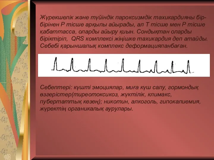 Жүрекшелік және түйіндік пароксизмдік тахикардияны бір-бірінен Р тісше арқылы айырады,