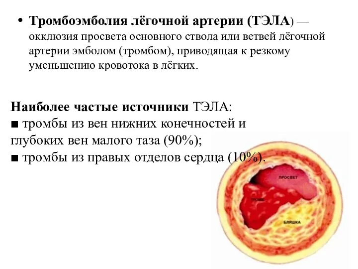 Тромбоэмболия лёгочной артерии (ТЭЛА) — окклюзия просвета основного ствола или