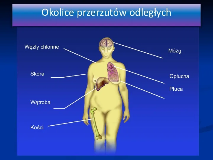 Skóra Wątroba Kości Opłucna Płuca Węzły chłonne Mózg Okolice przerzutów odległych